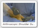 Arthroscopic Shoulder Surgery